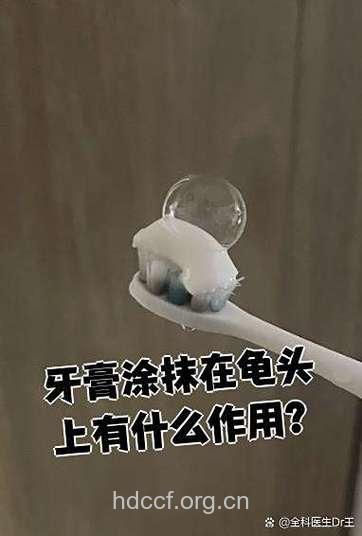 牙膏抹在龟头竟然可治早泄?