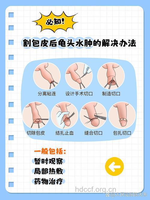 男性包茎有哪些危害 怎么治疗男性包茎