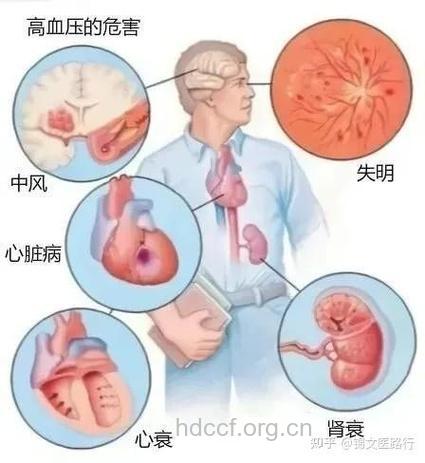 空气污染与高血压有关吗,