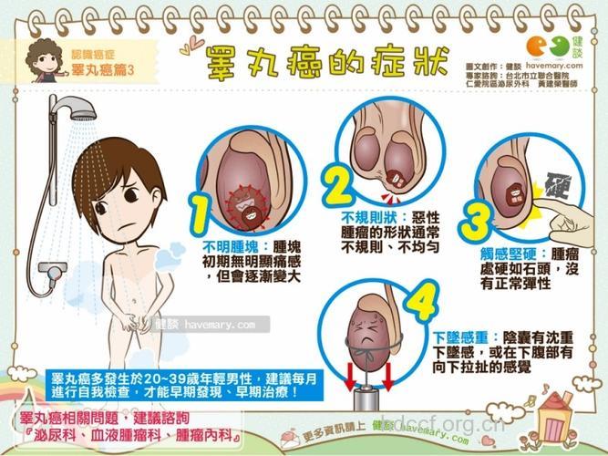 男人要知道睾丸癌早期症状