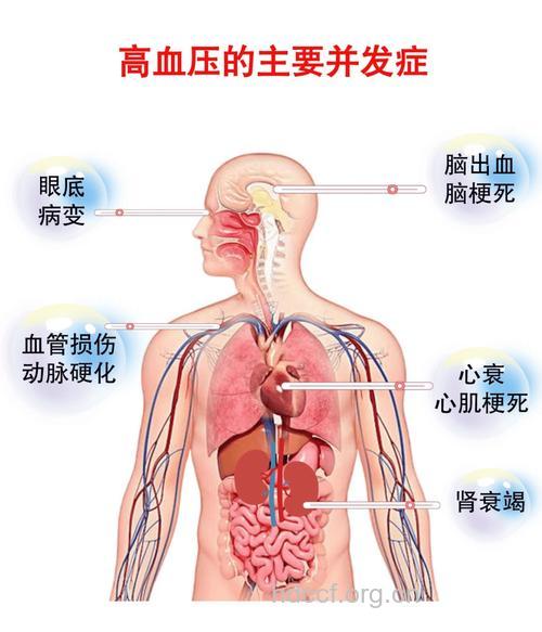 高血压对人体危害及并发症