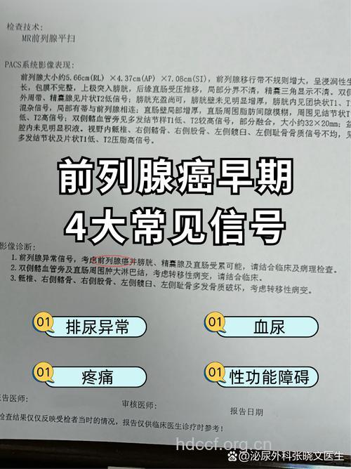 5个症状警惕前列腺癌 男人怎样预防前列腺癌