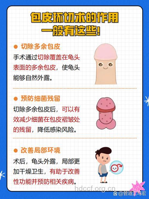 包皮手术前须知 包皮手术有何特点