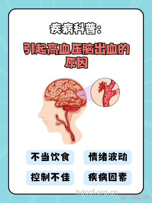 高血压是如何引发脑溢血的