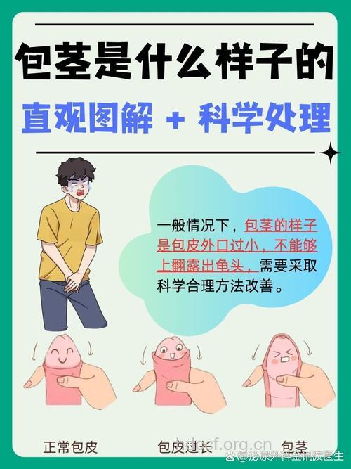 5个方法帮你判断包茎过长症状