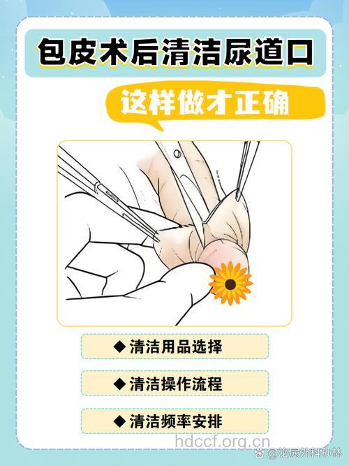 包茎术后如何清洗丁丁 术后注意五个点