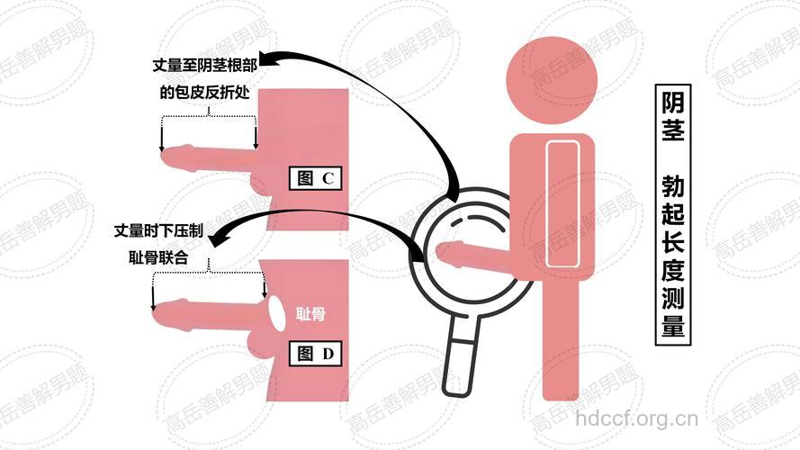 造成“小男人”的原因 小阴茎治疗术