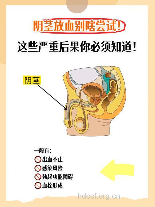 阴茎延长要慎重 莫让误区伤自己