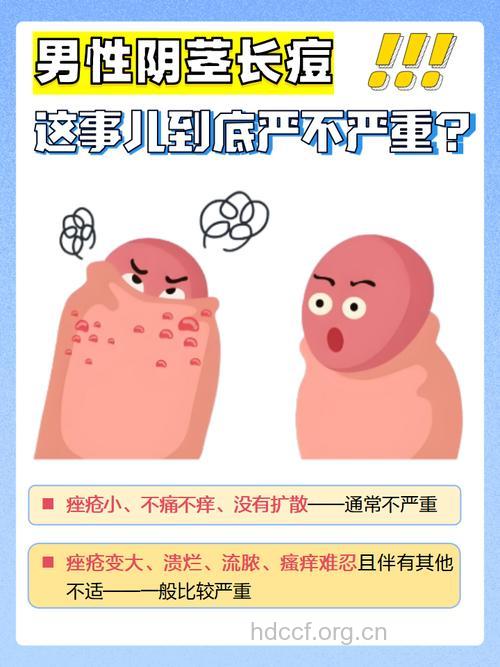 阴茎散发异味是什么原因 阴茎上为什么长痘痘