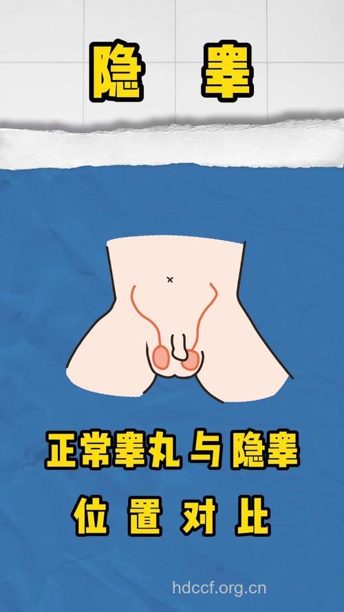 隐睾真的会传染吗