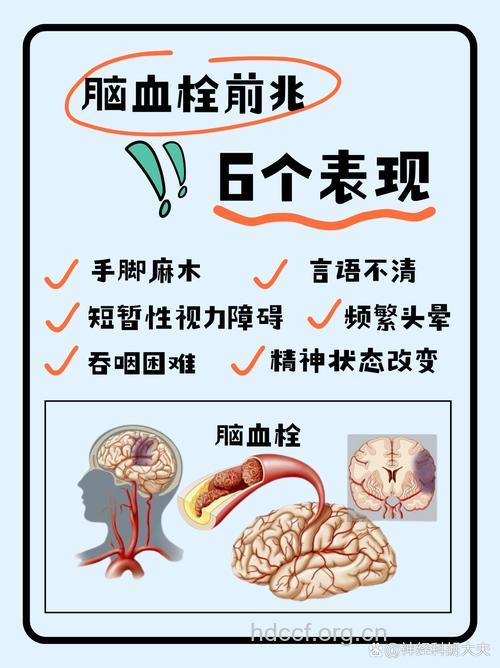到中年了离脑血栓警戒线也近了！