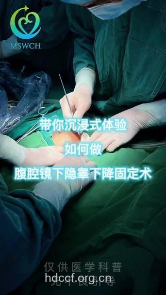 隐睾手术的常规步骤简介