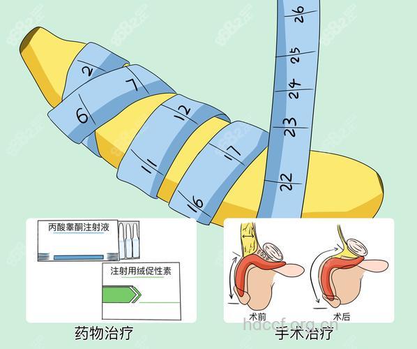 延长男性阴茎的几种常见方法