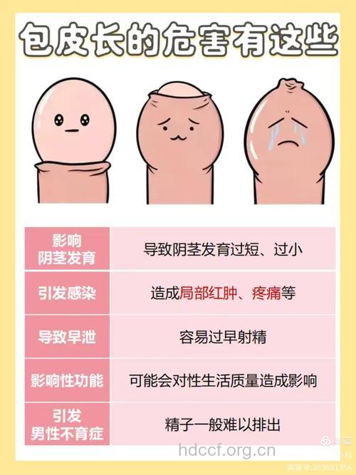 包皮过长的男性有哪些临床表现