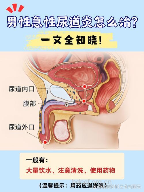 男人抽烟易患尿道炎吗 尿道炎的三种治疗方法