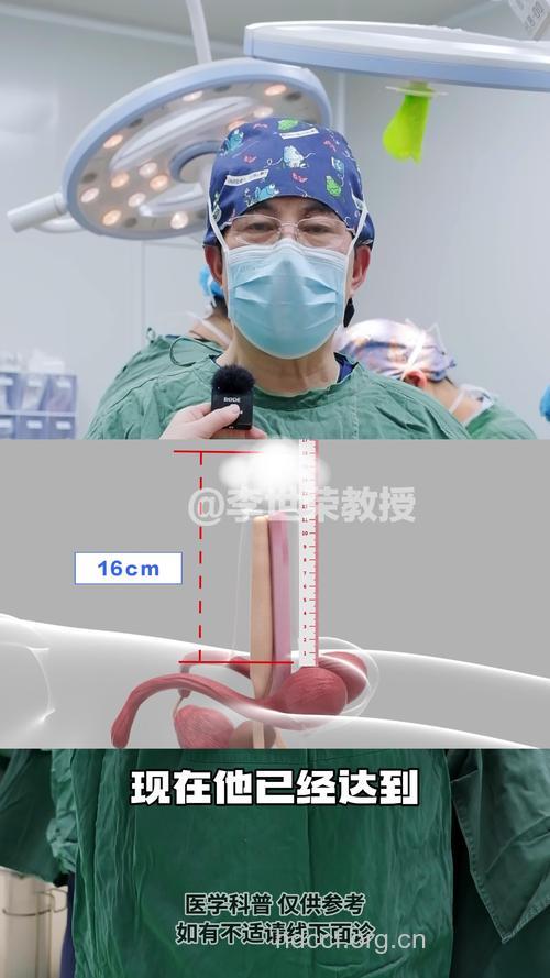 哪些男性可以做阴茎延长术