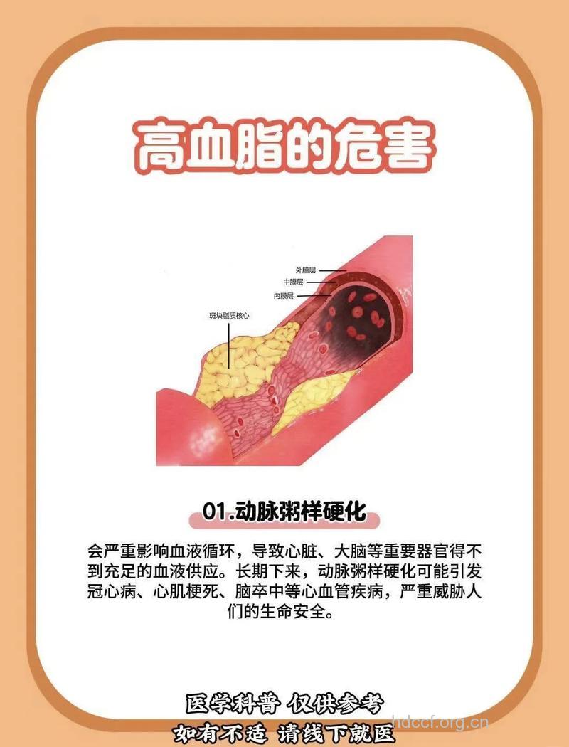 造成高血脂的原因有哪些
