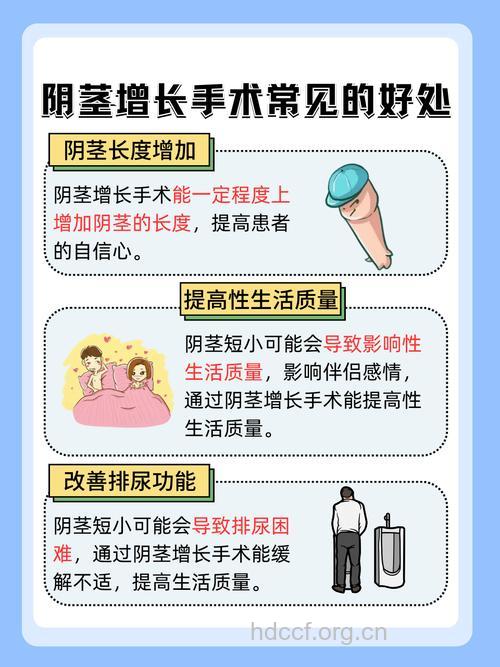 阴茎延长术怎样回事