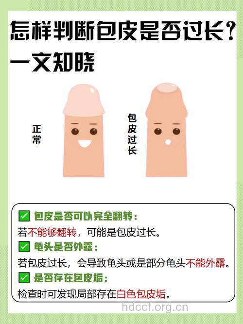 男人包皮过长该如何分辨?
