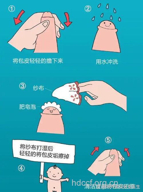 包皮过长 洗洗会更健康