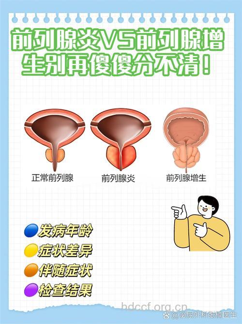 前列腺炎和前列腺增生的症状区别