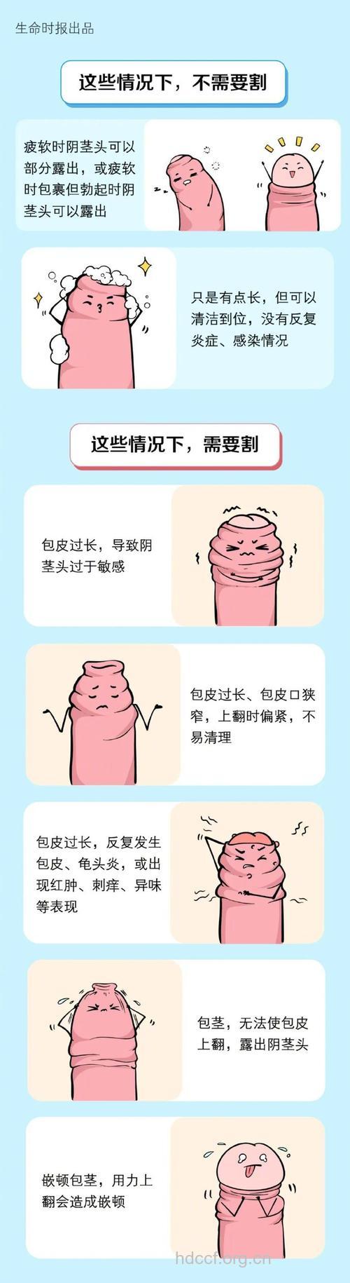 什么情况需要割包皮？