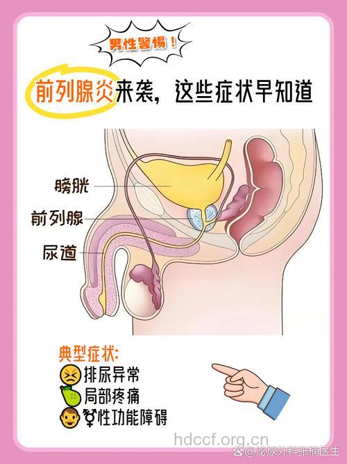 前列腺炎四种症状 春季教你防前列腺疾病