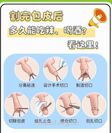 怎么自我矫治包皮过长？