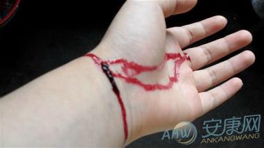 梦见自己割腕自杀是什么意思