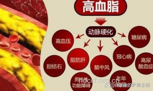 高血压高血脂同样会遗传