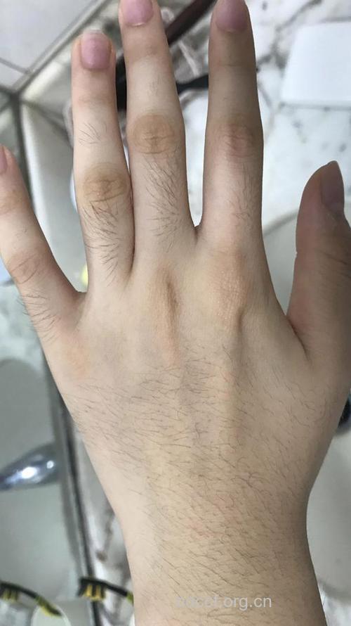 解梦大全之梦见汗毛是什么意思