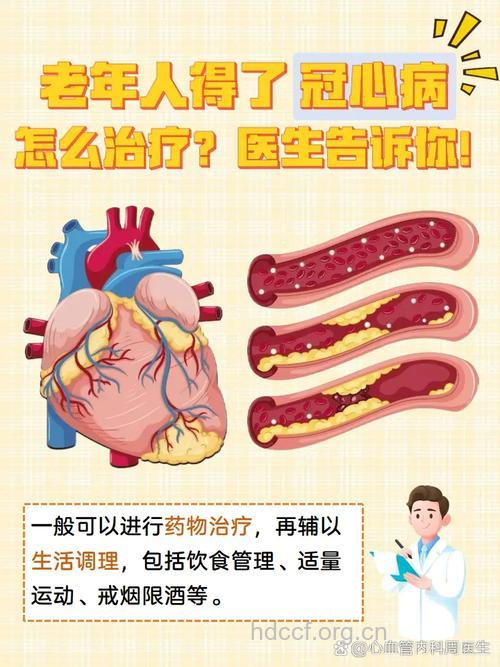 只有老人才会得冠心病吗？这些误区你要知道