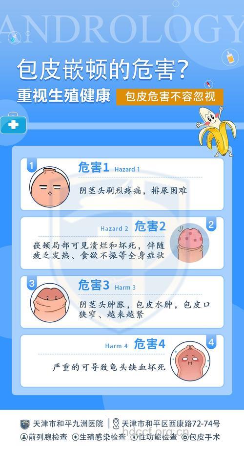 男人如何治疗包皮过长