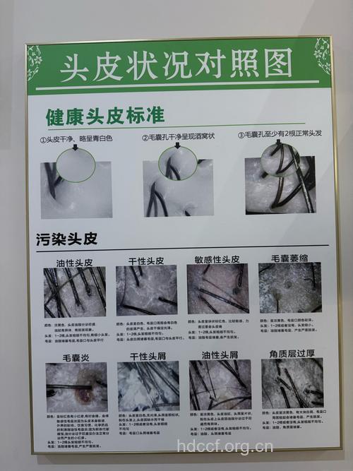 男人护理头发的误区