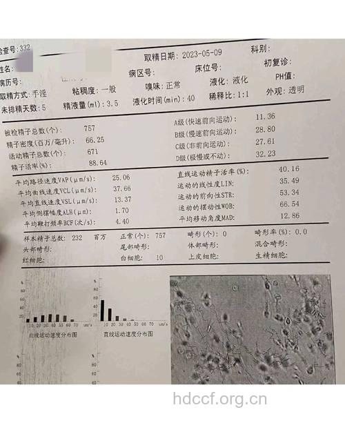 弱精症检查有四项