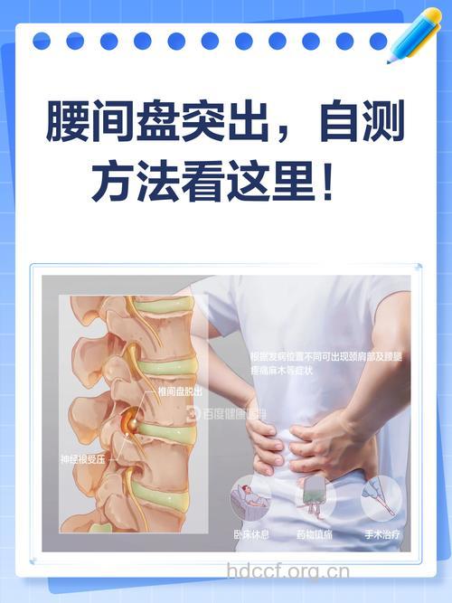 自测：你的腰椎有问题吗