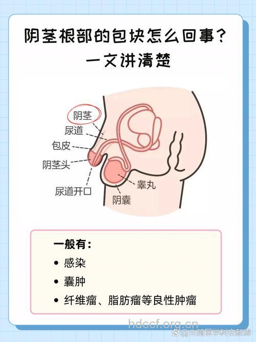 男性不育的祸根是什么