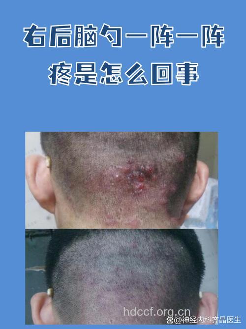 运动中要警惕7种不良症状