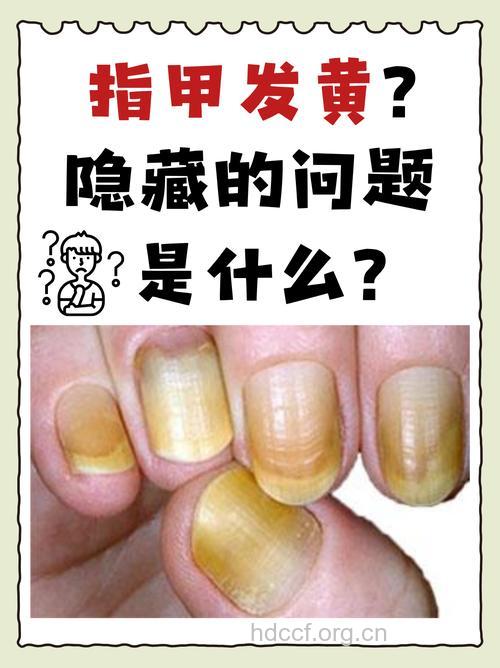 哪种指甲提示男人肾虚了