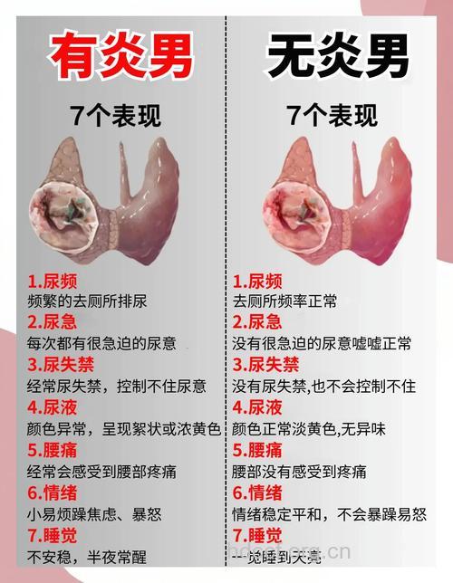 威胁男性健康的七大疾病