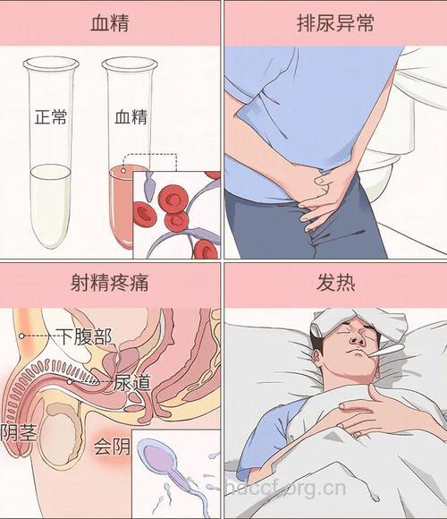 男性射精过多也是病 精液异常与哪些疾病有关
