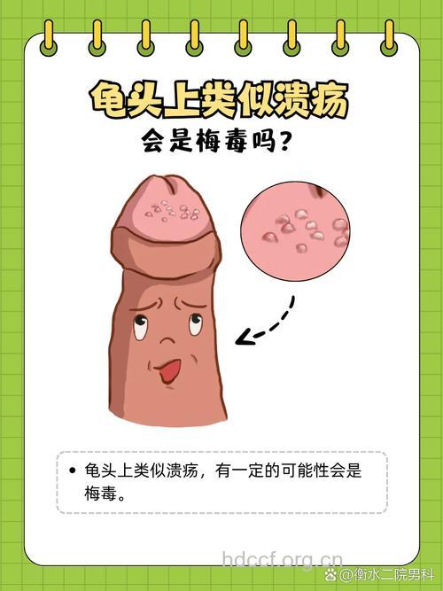 男人疾病的6个症状