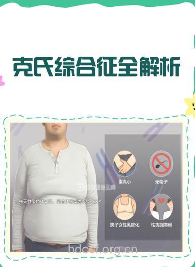 克氏综合征可致男性不育吗
