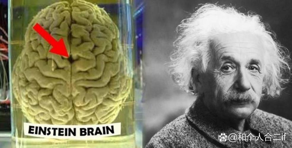 美科学家研究头顶球会损伤大脑