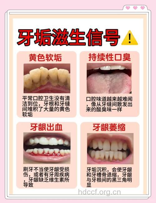 男人牙齿黑黄怎么办 哪些方法美白牙齿