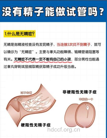 男性无精症的症状是怎么样的