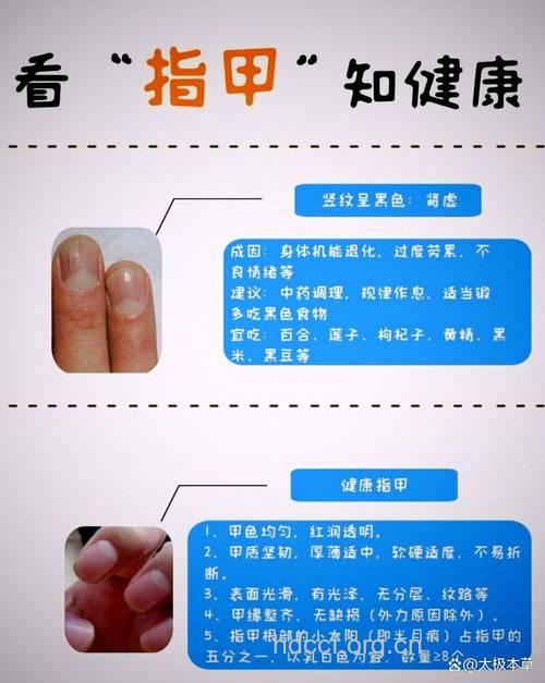 从指甲判断男人是否肾虚