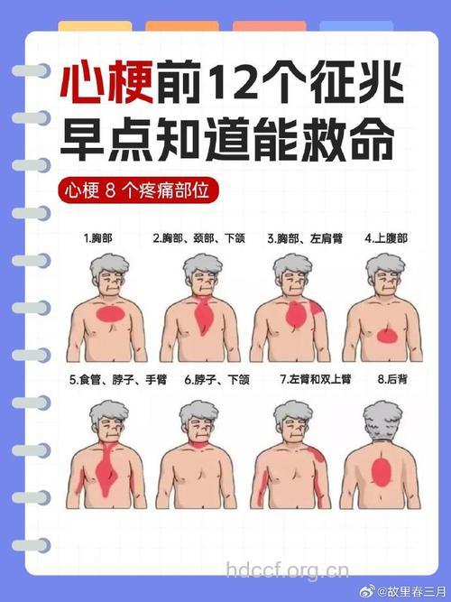 心肌梗死的早期症状有哪些