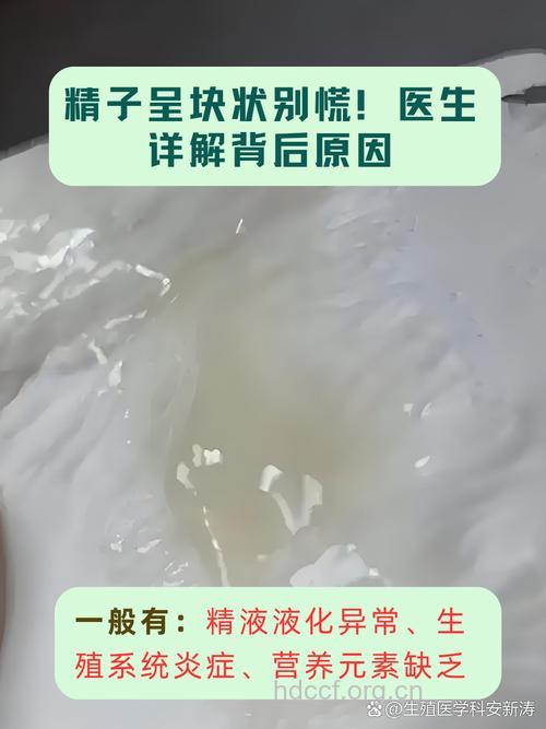 精液精子异常不育症