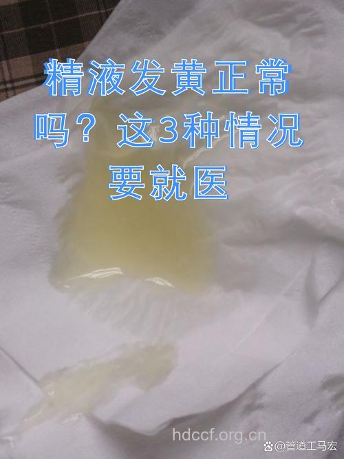 常见男性精子发生病变的前兆